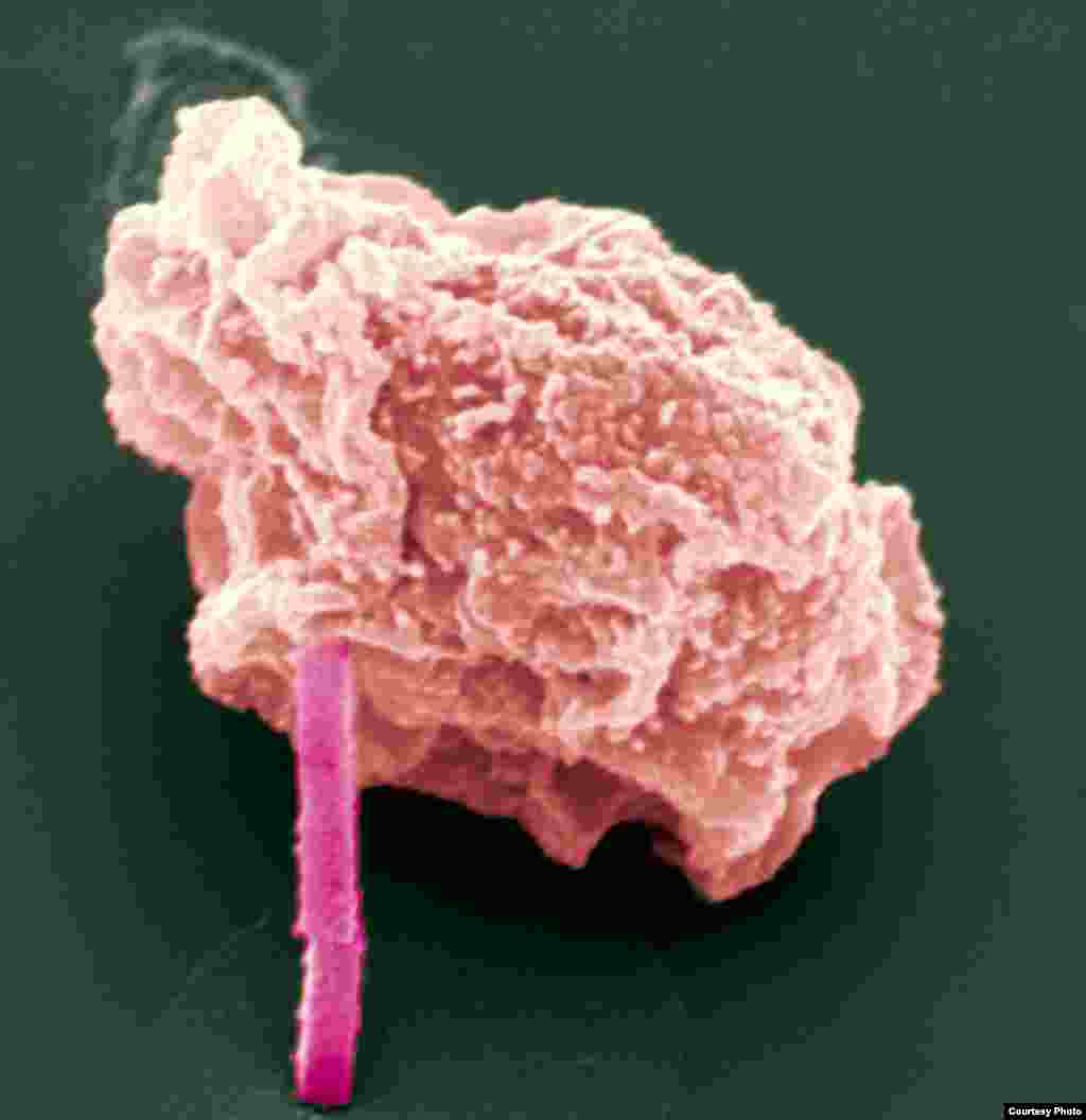 Researchers used a laser one billion times brighter than conventional X-ray sources to determine the structure of an enzyme required by the parasite that causes African sleeping sickness. (Michael Duszenko, University of Tübingen)