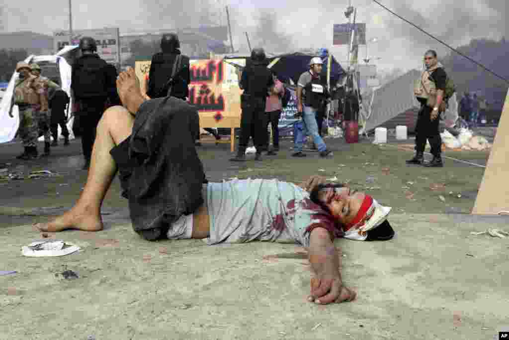 A wounded protester lies on the ground as Egyptian security forces clear the smaller of the two sit-ins by supporters of ousted Islamist President Mohammed Morsi, near the Cairo University campus in Giza, Cairo, Egypt, August 14, 2013.