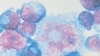 Color-Coded HIV Test Detects Infection Quickly and Cheaply